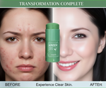 Charger l'image dans la galerie, Produit de visage  Green Mask
